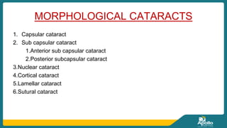 cataract....seminar....111.pptx