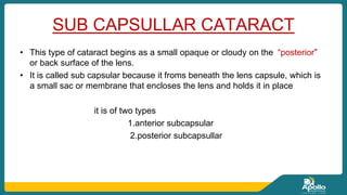 cataract....seminar....111.pptx