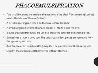 PHACOEMULSIFICATION
• Two small incisions are made in the eye where the clear front covering(cornea)
meets the white of the eye (sclera).
• A circular opening is created on the lens surface (capsule)
• A small surgical instrument (phaco probe) is inserted into the eye.
• Sound waves (ultrasound) are used to break the cataract into small pieces.
• Sometimes a laser is used too.The cataract and lens pieces are removed from
the eye using suction.
• An intraocular lens implant (IOL) may then be placed inside the lens capsule.
• Usually, the incisions seal themselves without stitches.
 