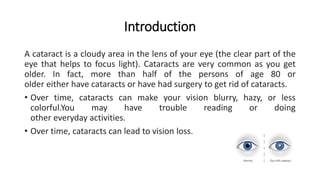 Introduction
A cataract is a cloudy area in the lens of your eye (the clear part of the
eye that helps to focus light). Cataracts are very common as you get
older. In fact, more than half of the persons of age 80 or
older either have cataracts or have had surgery to get rid of cataracts.
• Over time, cataracts can make your vision blurry, hazy, or less
colorful.You may have trouble reading or doing
other everyday activities.
• Over time, cataracts can lead to vision loss.
 
