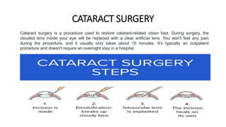 CATARACT SURGERY
Cataract surgery is a procedure used to restore cataract-related vision loss. During surgery, the
clouded lens inside your eye will be replaced with a clear artificial lens. You won't feel any pain
during the procedure, and it usually only takes about 15 minutes. It's typically an outpatient
procedure and doesn't require an overnight stay in a hospital.
 