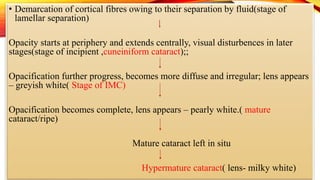 cataract.pptx