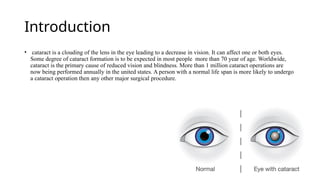 Introduction
• cataract is a clouding of the lens in the eye leading to a decrease in vision. It can affect one or both eyes.
Some degree of cataract formation is to be expected in most people more than 70 year of age. Worldwide,
cataract is the primary cause of reduced vision and blindness. More than 1 million cataract operations are
now being performed annually in the united states. A person with a normal life span is more likely to undergo
a cataract operation then any other major surgical procedure.
 