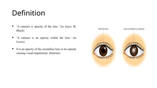 Definition
 ‘A cataract is opacity of the lens.’ (in Joyce M.
Black)
 ‘A cataract is an opacity within the lens.’ (in
Lewis)
 It is an opacity of the crystalline lens or its capsule
causing visual impairment. (Internet)
 