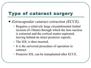 Type of cataract surgery Extracapsular cataract extraction (ECCE).  Requires a relatively large circumferential limbal incision (8-10mm) through which the lens nucleus is extracted and the cortical matter aspirated, leaving behind an intact posterior capsule.  The IOL is then inserted.  It is the universal procedure of operation in cataract.  Posterior IOL can be transplanted after ECCE. 