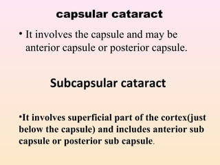 Cataract | PPT