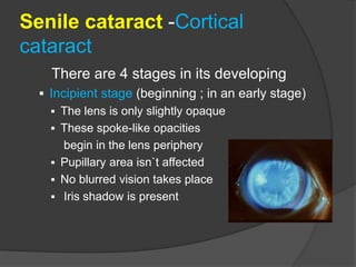 immature senile cataract iris shadow Images High... CATARACT-VVL.ppt