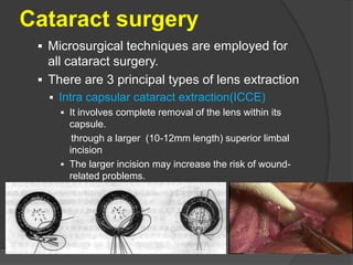 CATARACT-VVL.ppt