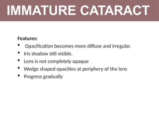Cataract 2.pptx ophthalmology lecture 22 | PPTX