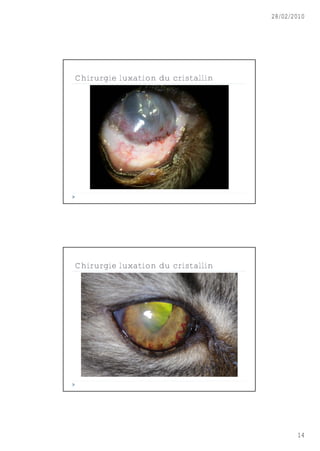 28/02/2010




Chirurgie luxation du cristallin




Chirurgie luxation du cristallin




                                          14
 