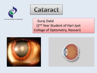-Suraj Dalal
(2nd Year Student of Hari Jyot
College of Optometry, Navsari)
 