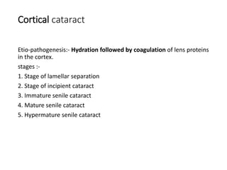 Cortical cataract
Etio-pathogenesis:- Hydration followed by coagulation of lens proteins
in the cortex.
stages :-
1. Stage of lamellar separation
2. Stage of incipient cataract
3. Immature senile cataract
4. Mature senile cataract
5. Hypermature senile cataract
 