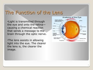 The Function of the Lens
•Light is transmitted through
the eye and onto the retina—
causing a chemical reaction
that sends a message to the
brain through the optic nerve.

•The lens assists in allowing
light into the eye. The clearer
the lens is, the clearer the
image.




                                  2
 