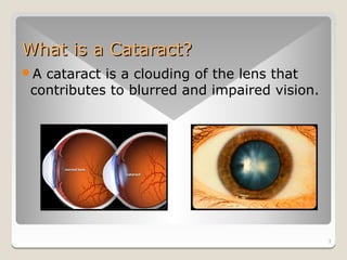 What is a Cataract?
Acataract is a clouding of the lens that
contributes to blurred and impaired vision.




                                              3
 
