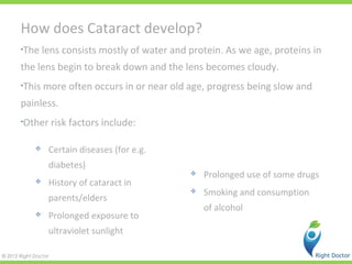 Cataract | PPT
