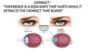 CATARACT :
“EXPERIENCE IS A KEEN KNIFE THAT HURTS WHILE IT
EXTRACTS THE CATARACT THAT BLINDS”
 