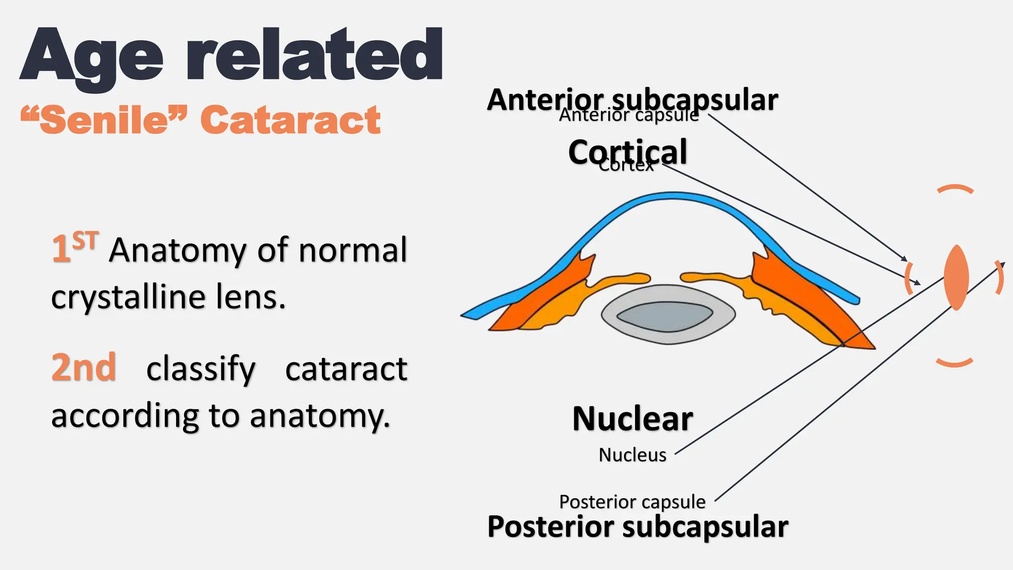 Cataract Slide Pptx