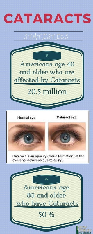 CATARACTS
STATISTICS
Americans age 40
and older who are
affected by Cataracts
#
20.5 million
Americans age
80 and older
who have Cataracts
%
50 %
 