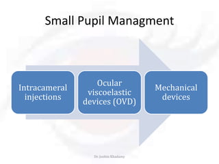 Pupil Injection Cataract Surgery: Small Pupil by Dr Joobin Khadamy | PPTX