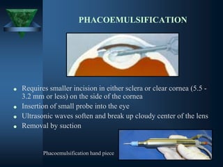 PHACOEMULSIFICATION
• Requires smaller incision in either sclera or clear cornea (5.5 -
3.2 mm or less) on the side of the cornea
• Insertion of small probe into the eye
• Ultrasonic waves soften and break up cloudy center of the lens
• Removal by suction
Phacoemulsification hand piece
 