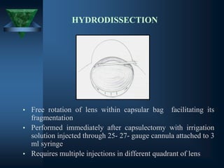 HYDRODISSECTION
• Free rotation of lens within capsular bag facilitating its
fragmentation
• Performed immediately after capsulectomy with irrigation
solution injected through 25- 27- gauge cannula attached to 3
ml syringe
• Requires multiple injections in different quadrant of lens
 