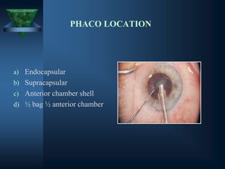 PHACO LOCATION
a) Endocapsular
b) Supracapsular
c) Anterior chamber shell
d) ½ bag ½ anterior chamber
 