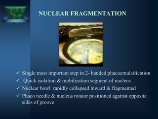 NUCLEAR FRAGMENTATION
✓ Single most important step in 2- handed phacoemulsification
✓ Quick isolation & mobilization segment of nucleus
✓ Nuclear bowl rapidly collapsed inward & fragmented
✓ Phaco needle & nucleus rotator positioned against opposite
sides of groove
 