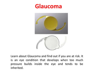 Glaucoma
Learn about Glaucoma and find out if you are at risk. It
is an eye condition that develops when too much
pressure builds inside the eye and tends to be
inherited.