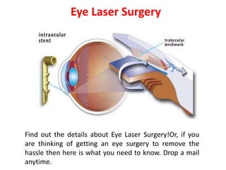 Eye Laser Surgery
Find out the details about Eye Laser Surgery!Or, if you
are thinking of getting an eye surgery to remove the
hassle then here is what you need to know. Drop a mail
anytime.