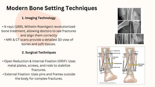 Cataract Surgery, Bone Setting And Plastic Surgery (2).pdf