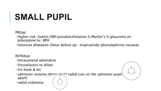 SMALL PUPIL
PREop:
 Higher risk: Uveitis/DM/pseudoexfoliation S/Marfan’s S/glaucoma on
pilocarpine tx/ BPH
 Intensive dilatation 2Hour before op : tropicamide/phenylephrine/nevanac
INTRAop:
 Intracameral adrenaline
 Viscoelastics to dilate
 Iris hook & etc
 sphincter-ectomy (three small radial cuts on the sphincter pupillae, 120°
apart)
 radial iridotomy
 
