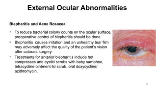 Cataract Surgery in Special Situations- Dr. Prabhat Devkota.pptx