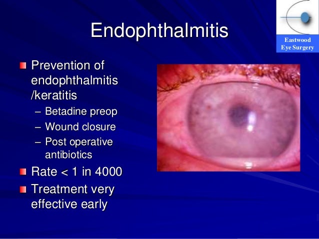 Cataract Surgery Complications for General Practitioners