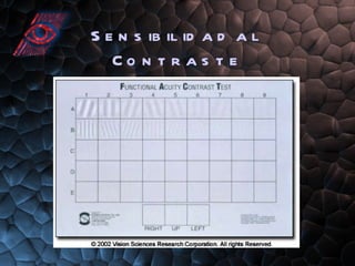 Sensibilidad al Contraste 
