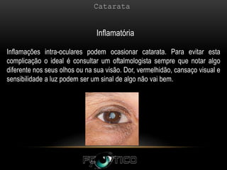 Inflamações intra-oculares podem ocasionar catarata. Para evitar esta
complicação o ideal é consultar um oftalmologista sempre que notar algo
diferente nos seus olhos ou na sua visão. Dor, vermelhidão, cansaço visual e
sensibilidade a luz podem ser um sinal de algo não vai bem.
Inflamatória
 