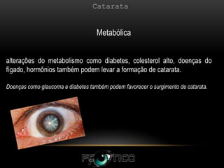 alterações do metabolismo como diabetes, colesterol alto, doenças do
fígado, hormônios também podem levar a formação de catarata.
Doenças como glaucoma e diabetes também podem favorecer o surgimento de catarata.
Metabólica
 