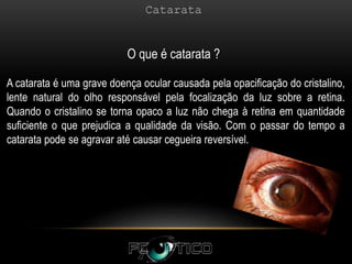 O que é catarata ?
A catarata é uma grave doença ocular causada pela opacificação do cristalino,
lente natural do olho responsável pela focalização da luz sobre a retina.
Quando o cristalino se torna opaco a luz não chega à retina em quantidade
suficiente o que prejudica a qualidade da visão. Com o passar do tempo a
catarata pode se agravar até causar cegueira reversível.
 