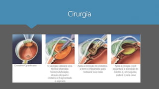 Cirurgia
 