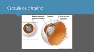 Cápsula de cristalino
 