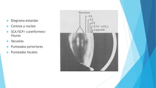  Diagrama estandar
 Corteza y nucleo
 SCA/SCP/ cuneiformes/
fisuras
 Vacuolas
 Punteados psrteriores
 Punteados focales
 
