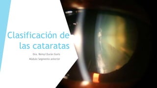 Clasificación de
las cataratas
Dra. Remyi Durán Goris
Módulo Segmento anterior
 