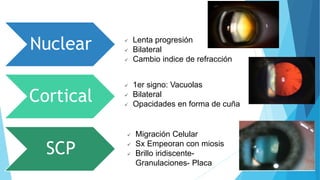 Nuclear
Cortical
SCP
 1er signo: Vacuolas
 Bilateral
 Opacidades en forma de cuña
 Migración Celular
 Sx Empeoran con miosis
 Brillo iridiscente-
Granulaciones- Placa
 Lenta progresión
 Bilateral
 Cambio indice de refracción
 