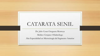 CATARATA SENIL
Dr. Julio Cesar Oceguera Montoya
Médico Cirujano Oftalmólogo
Alta Especialidad en Microcirugía del Segmento Anterior
 