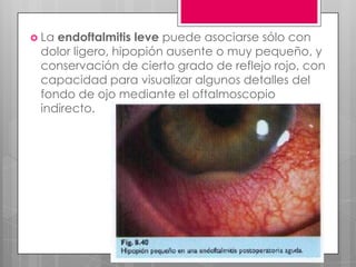  La endoftalmitis leve puede asociarse sólo con
dolor ligero, hipopión ausente o muy pequeño, y
conservación de cierto grado de reflejo rojo, con
capacidad para visualizar algunos detalles del
fondo de ojo mediante el oftalmoscopio
indirecto.
 