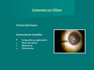 catarata-en-ni-os-ppt