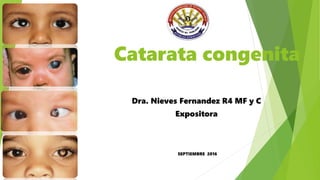 Catarata congenita
Dra. Nieves Fernandez R4 MF y C
Expositora
SEPTIEMBRE 2016
 