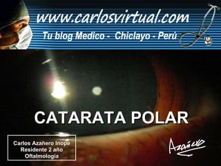 Carlos Azañero Inope Residente 2 año Oftalmología CATARATA POLAR 