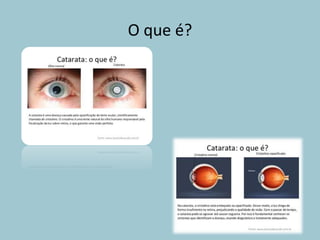 O que é?
 