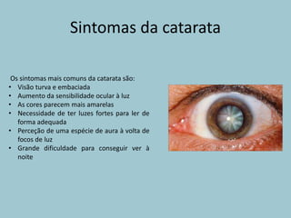 Sintomas da catarata
Os sintomas mais comuns da catarata são:
• Visão turva e embaciada
• Aumento da sensibilidade ocular à luz
• As cores parecem mais amarelas
• Necessidade de ter luzes fortes para ler de
forma adequada
• Perceção de uma espécie de aura à volta de
focos de luz
• Grande dificuldade para conseguir ver à
noite
 