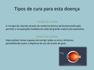 Tipos de cura para esta doença
A cirurgia da catarata através da moderna técnica da facoemulsificação
permite a recuperação imediata da visão da grande maioria dos pacientes.
Lentes intra-oculares
Hoje existem lentes capazes de corrigir todos os erros refrativos,
possibilitando assim a dispensa do uso de óculos de grau.
Cirurgia da catarata
 
